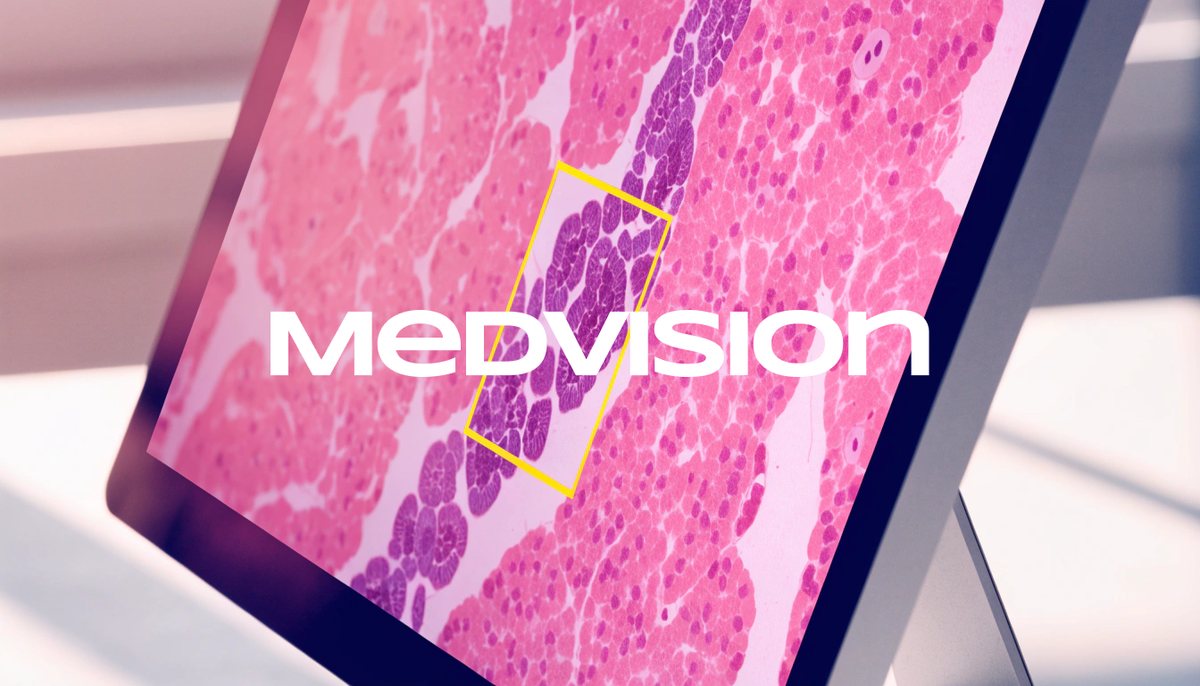 MedVision